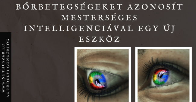 borbetegseg_google